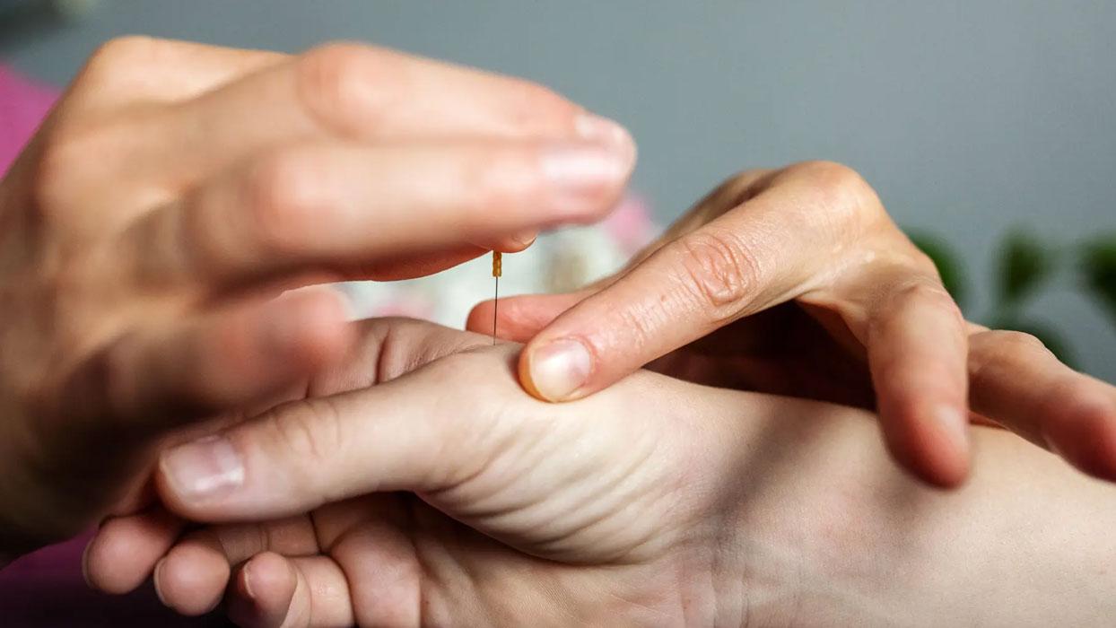 Akupunkturun inme sonrası konuşma güçlüğü çekenlerin tedavisine katkıda bulunduğu belirlendi