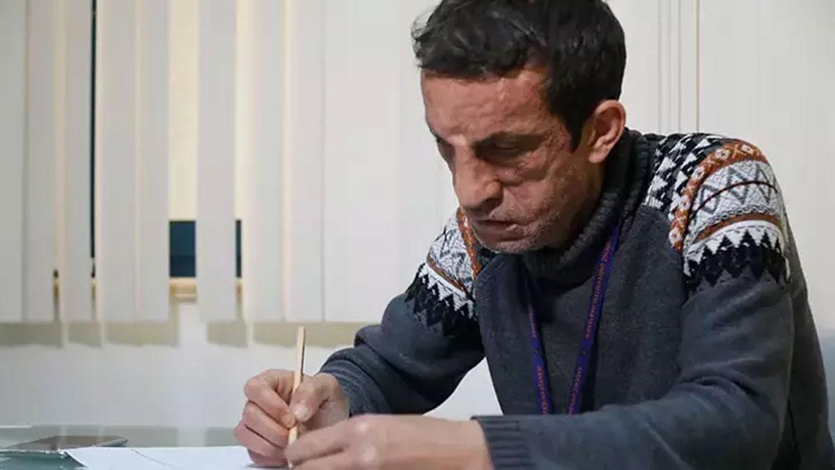 Türkiye'nin ilk yüz nakillisi Acar, üniversiteye hazırlanıyor