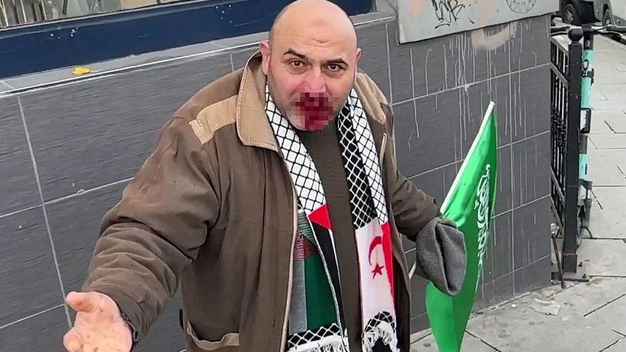 Filistin'e destek yürüyüşünden dönen vatandaşa yumruk atan sanık hakim karşısında