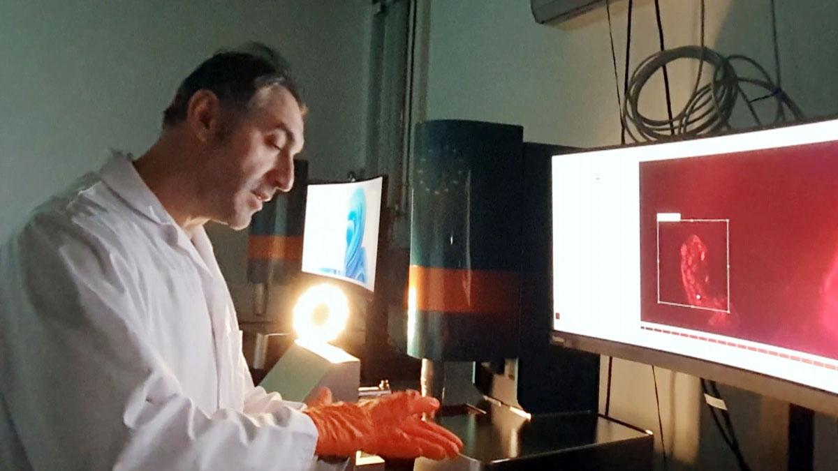 Dünya Tıp tarihinde bir Türk'ün imzası: Organ nakli tarih olacak