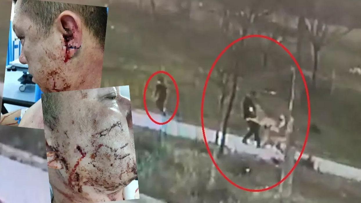 Başıboş köpek dehşet saçtı... Oğlu için kendini feda etti