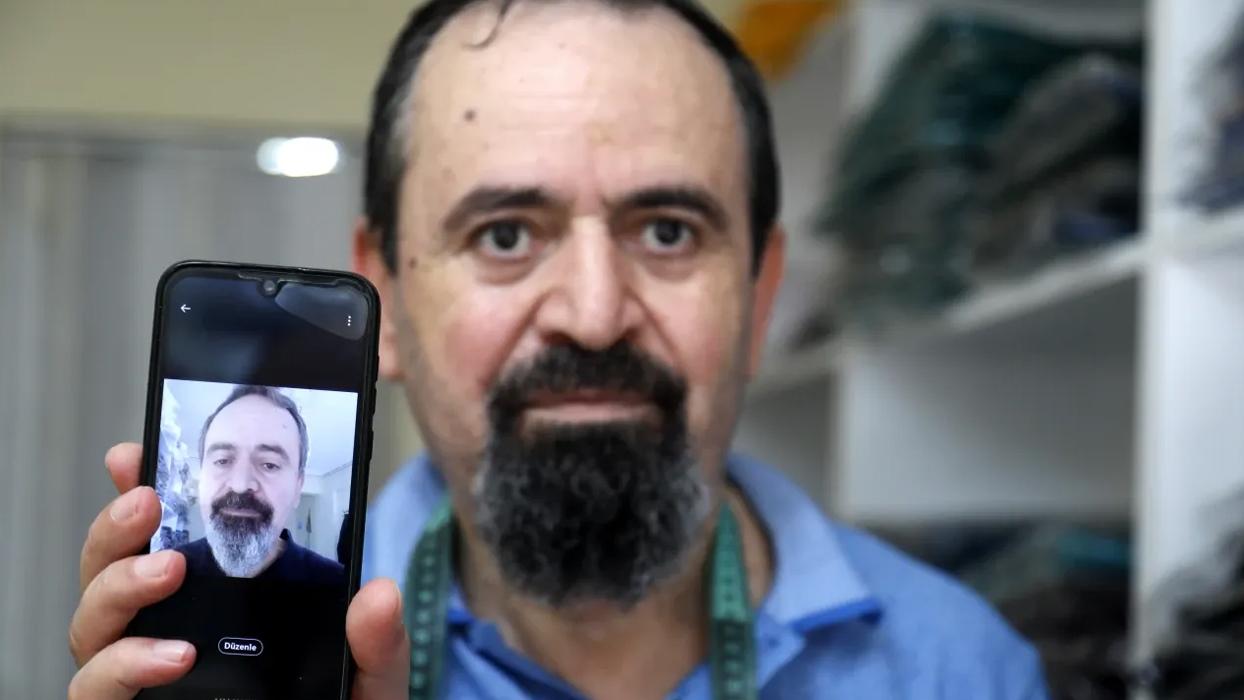 Kanser tedavisi gördü, beyaz saçı ve sakalı siyah uzadı