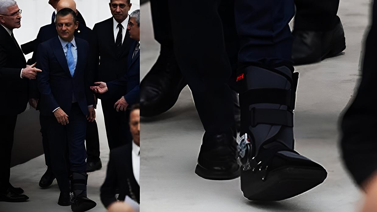 Özgür Özel'in ayağına ne oldu?