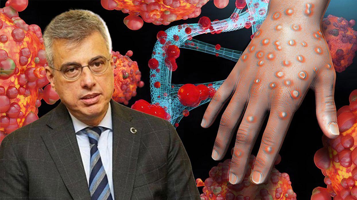 Bakan Memişoğlu: Maymun çiçeği için ekstra bir tedbire ihtiyaç yok