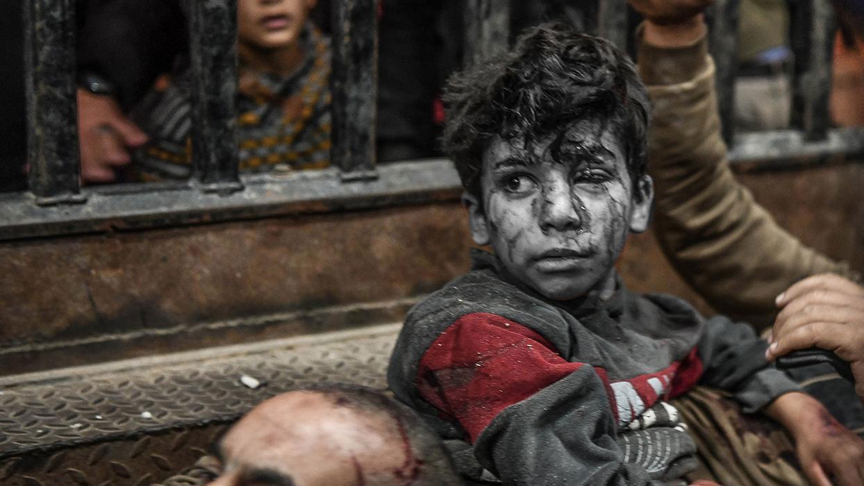 İsrail'in Gazze'ye saldırıları ölen çocukların yanında kurtulanların da hayatını karartıyor