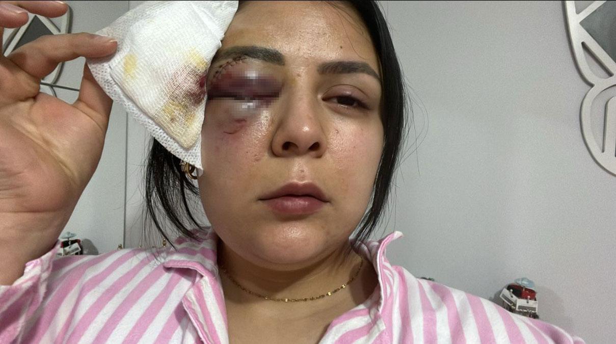 Pazarcık'ta kadına yumruk atan şüpheli tutuklandı