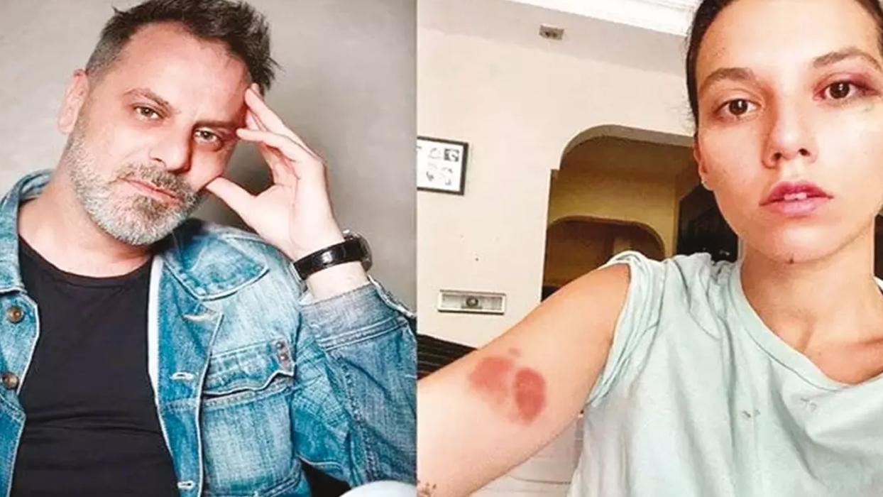 ‘Yaralama'ya 2 yıl hapis! Karar onanırsa cezaevine girecek