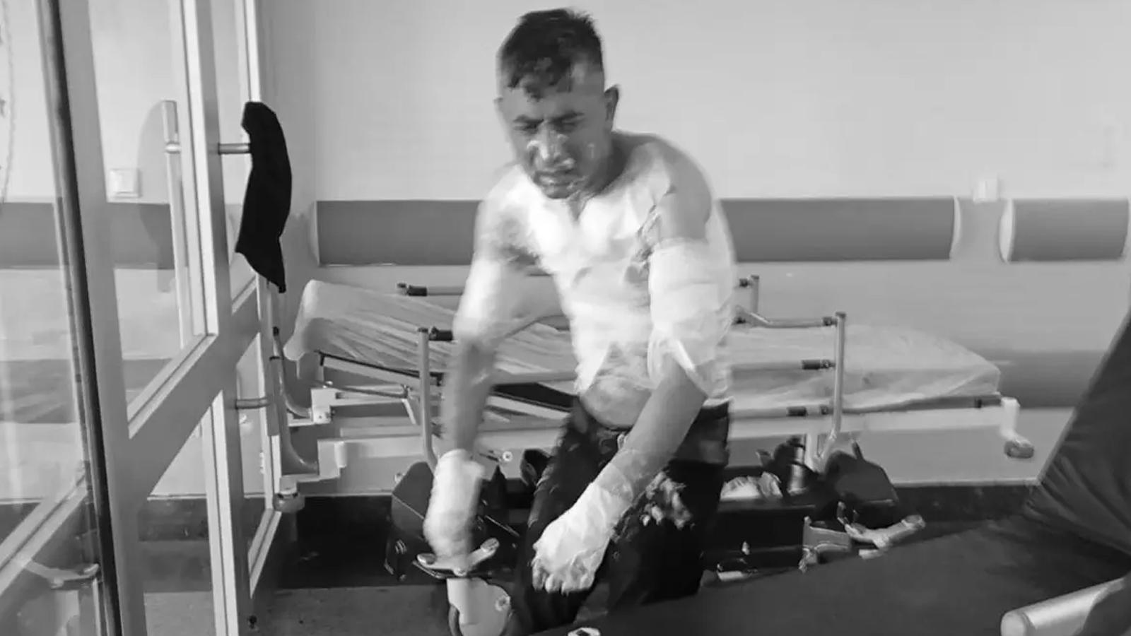 Engelli oğluna saldırıda bulunan şüpheli hakkında suç duyurusu yapıldı