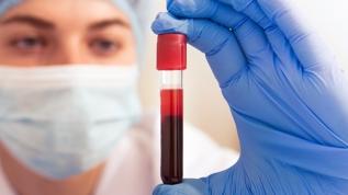 En şüpheci kan grubu ortaya çıktı! Onlar kimseye kolay güvenmiyor