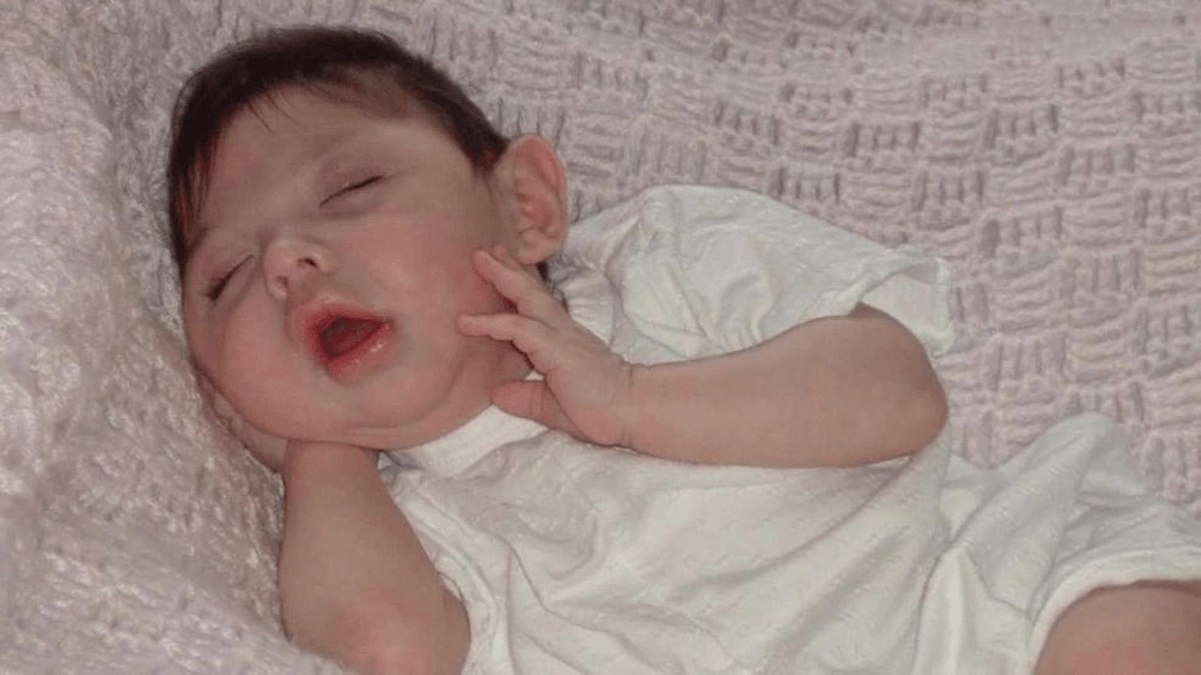 Beyni olmadan yaşayan Alex Simpson'ın 20. yaş mucizesi