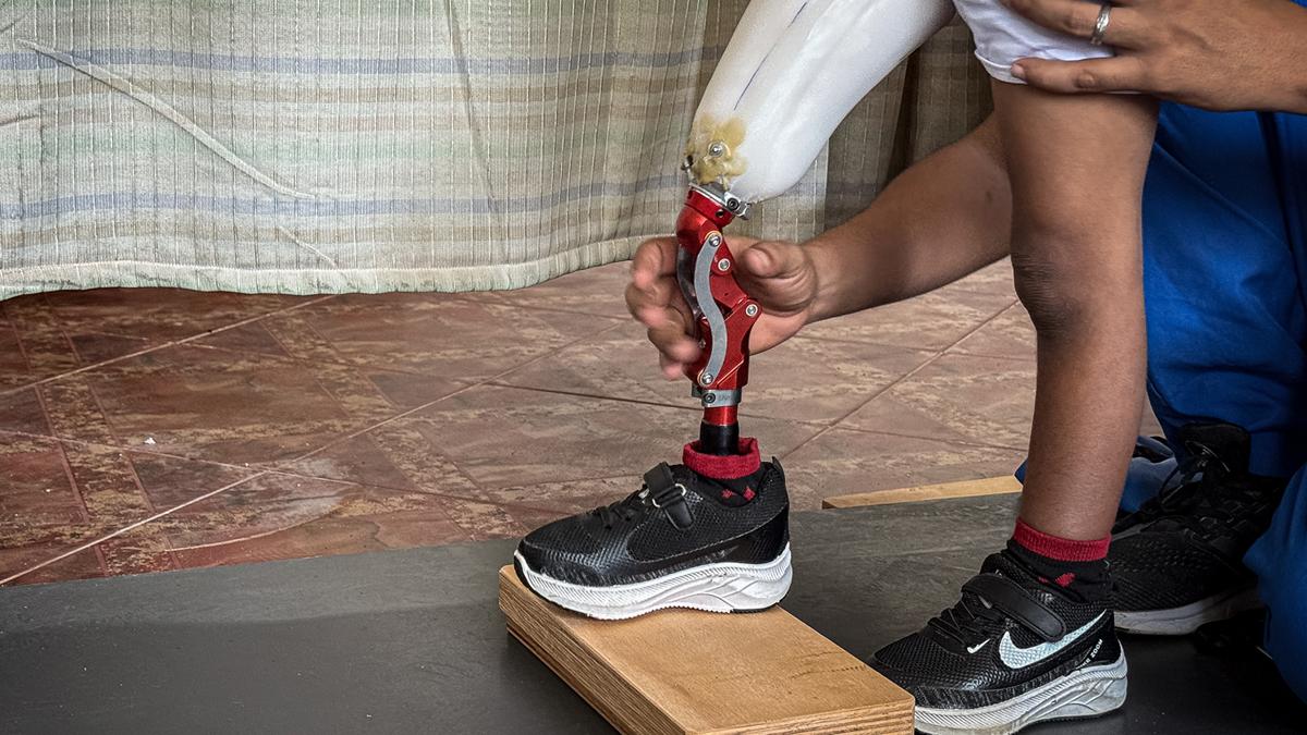 Gazze'de uzuv kayıpları artıyor! Evde yapılan protezler umut ışığı olmaya çalışıyor