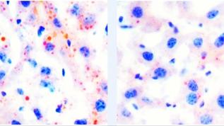 Bilim insanları egzersizin yaşlanma karşıtı gücünün sırrını çözdü