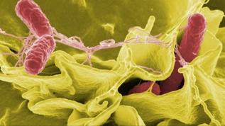 Parkinson hastalığı bağırsak bakterileriyle bağlantılı olabilir...