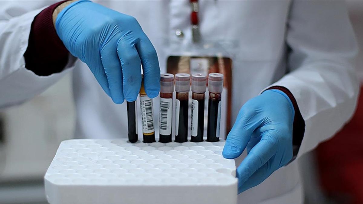 Uzun COVID hastalarının kanında garip yapılar keşfedildi