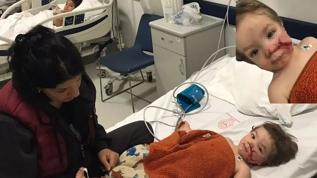 Başkentte 2 çocuğu yaralayan pitbull cinsi köpeğin sahibi tutuklandı