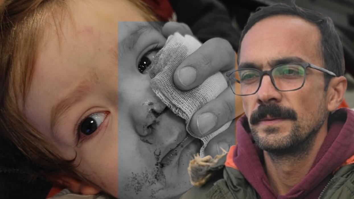 "Bu kadın dışarı çıkarsa biz bir daha rahat uyuyamayız" Ankara'da pitbull saldırısına uğrayan çocukların babası çağrıda bulundu!