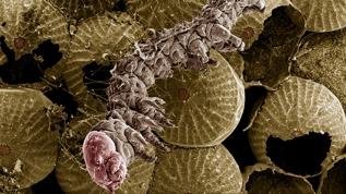 Tardigradların sırrı insan sağlığını değiştirebilir