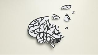 Kur Korumalı TL Vadeli Mevduat Hesabı