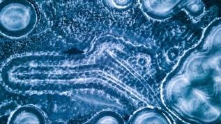 Mitokondri DNA'sı yaşlanmada iltihaplanmaya neden oluyor