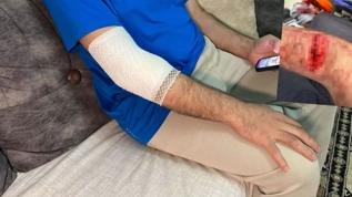 Başakşehir'de güvenlik görevlisine köpek saldırısı