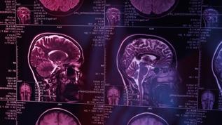 Görünmez tehlike! Beyin sağlığınızı sabote eden 8 alışkanlık ortaya çıktı