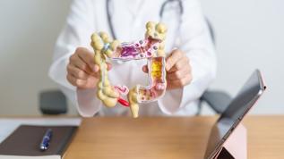 Bilim insanlarından kolorektal kanserde çığır açan keşif