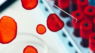 Kandaki bu mineral kanser hastalarının yaşam süresini uzatabilir