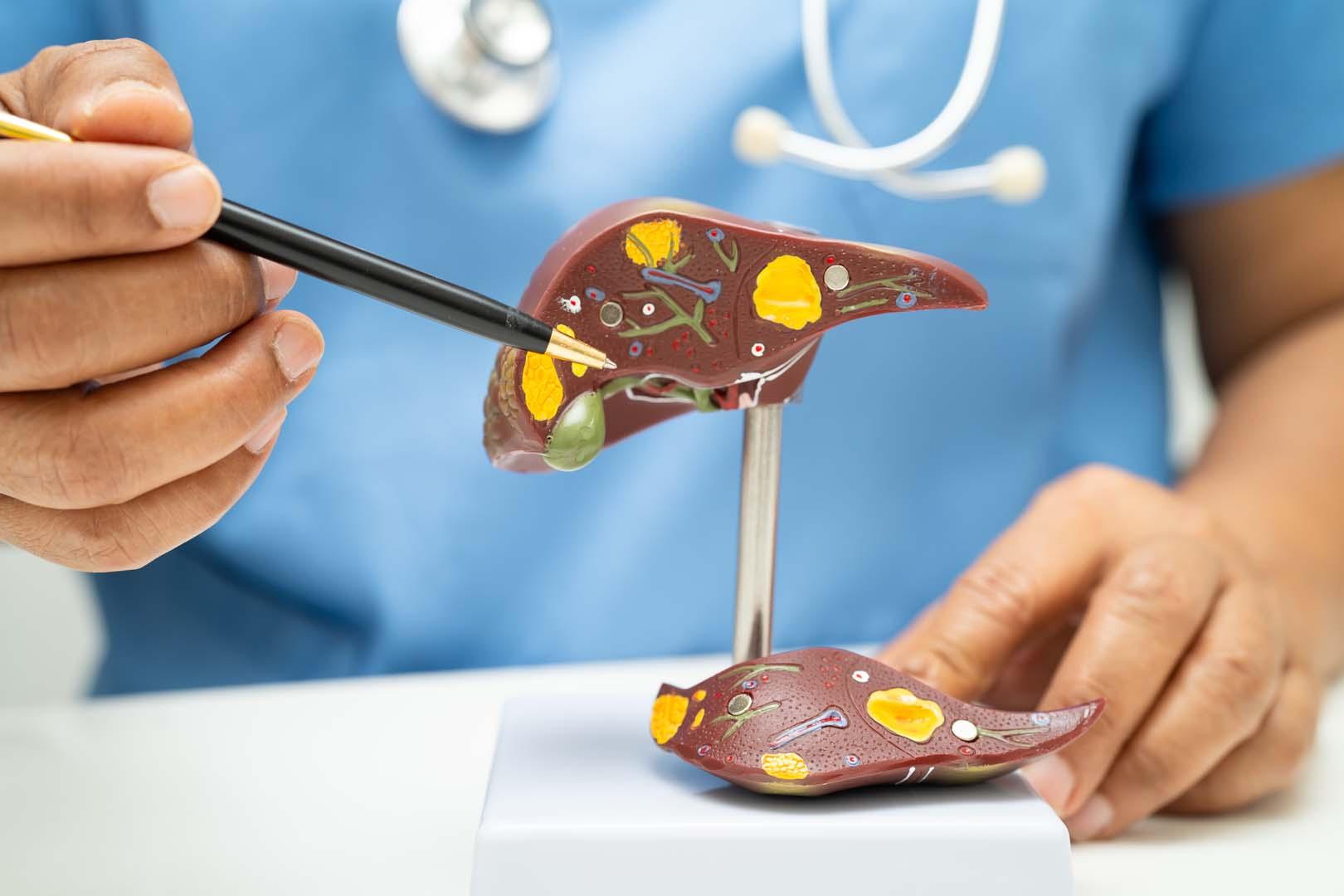 Şaşırtan bulgular! Yağlı diyetin karaciğere verdiği hasar