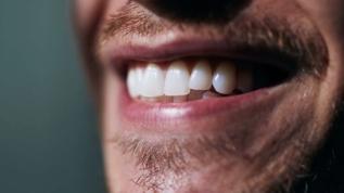 Diş sağlığı erken ölüm riskini gösterebiliyor