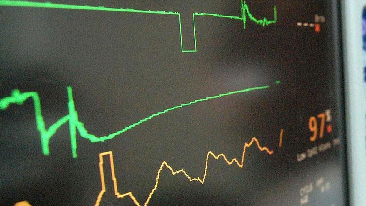 Kalp hastaları için önemli adım! Tüm hastanelerde uygulanacak