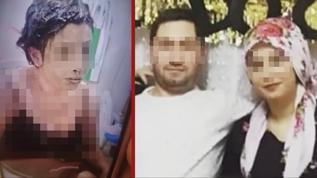 Genç kadın kör oldu! Kezzaplı eski koca dehşeti