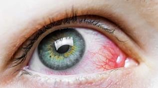 Gözde gizlenen bakteri beyni nasıl etkiliyor? Cedars-Sinai araştırması şaşırttı