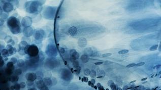 Kur Korumalı TL Vadeli Mevduat Hesabı