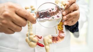 Gizemli bağırsak mikrobiyomu keşfedildi! Sağlıklı kişilerde yüksek oranda rastlandı