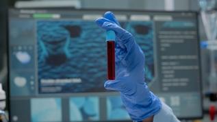 ApoB testi kalp sağlığında yeni dönemi başlatıyor