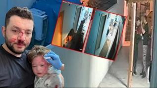 Baba ve bebeğine darp soruşturmasında algı iddiası: Çocuğu görmelerine rağmen devam ettiler