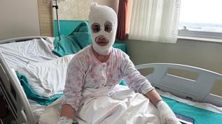 Patlayan düdüklü tencere hastanelik etti