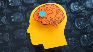 Alzheimer tedavisinde dev adım! Bilim insanları doğal savunma sistemini ortaya çıkardı