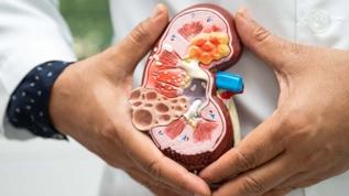 Böbrek hastaları için yeşil çayda dikkat edilmesi gerekenler