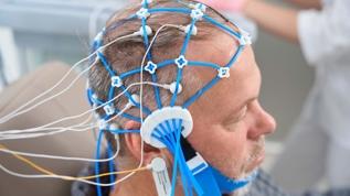 Alzheimer tedavisinde yeni umut! Metal iyonları süreci tersine çevrildi