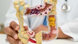 Bağırsak sağlığı için 5 kritik meyve önerisi