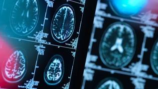 Çığır açan beyin haritası! Duyguların gizemi çözüldü