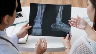 Uzmanlardan çağrı! Kemik sağlığı için asansör yerine merdiven kullanın