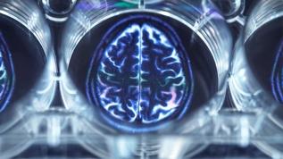 Beynin sıcak ve soğuğu algılayan merkezi ilk kez ortaya çıktı