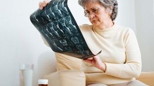 50 yaş üstü kadınlarda kemik erimesi riski artıyor! Hangi gıdalar koruyor?