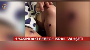 1 yaşındaki bebeğe İsrail vahşeti!