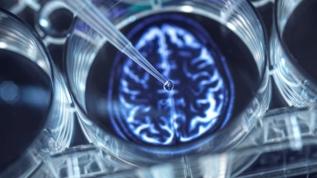 Beyin araştırmalarında yeni dönem! Işık parçacıkları bilinçle ilişkilendirildi
