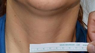 Tiroit sağlığı için uzmanlardan kritik beslenme uyarısı