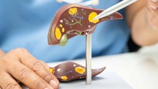 14 bin kişi incelendi! Karaciğer yağlanmasında dikkat çeken veri