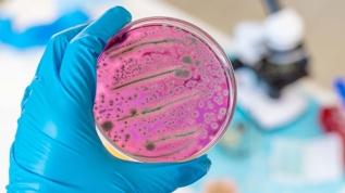 Görünmeyen tehlike! Bakteriler kimyasalları saklıyor